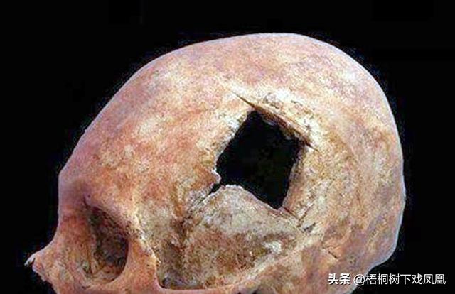 令人难以置信的史前考古发现，头部有一个洞是开颅手术还是吸吮人脑？